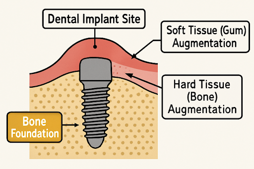 Tissue Grafting
